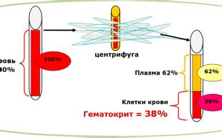 hct программа|Повышен hct в анализе крови.